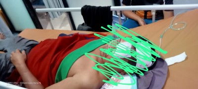 Abdullah Kritis Dibacok Saat Hendak Membela…